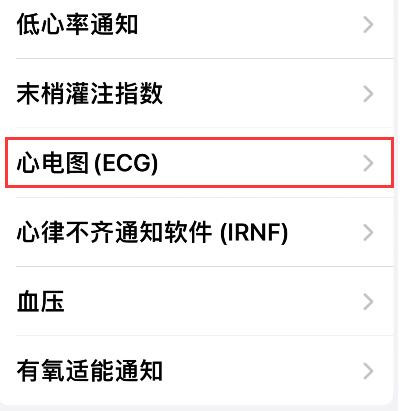 Apple Watch怎么查看心电图